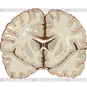 Pixelated human brain isolated on white - vector image