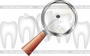 Decayed tooth under magnifying glass - vector image