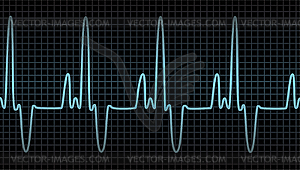 Vector electrocardiogram  - vector clip art