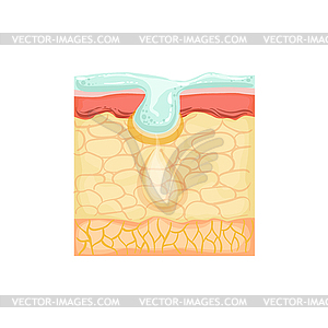 Dermatology Skincare Anatomical Info Demonstrating - vector image