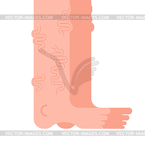 Varicose legs . Veins Disease of foot. illustrati - vector clipart