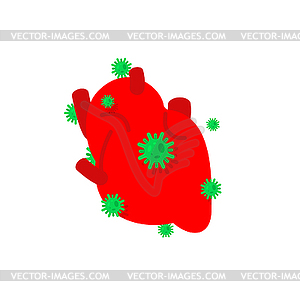 Sick heart. Diseased internal organ. Aching - vector clipart