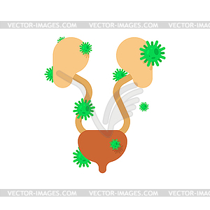 Sick kidneys. Diseased internal organ. Aching - vector image