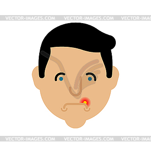 Herpes on lip man. Cold on mouth male - vector clip art