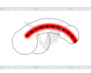 Penis sick. Venereal diseases. gonorrhea and - vector image