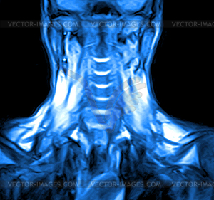 Magnetic resonance imaging of cervical spine - vector clip art