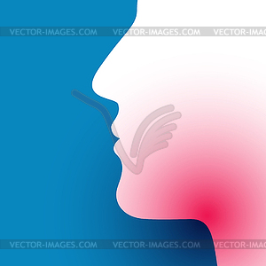 Sore throat - vector image