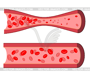 vascular clip art clip art