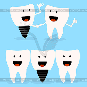 Dental implant - vector clipart