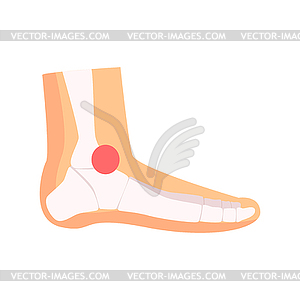 Ankle joint pain cartoon - vector clipart