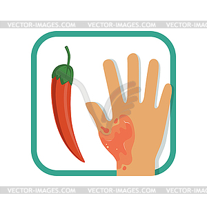 Burn of hand with red hot chili pepper. Burn of - vector clip art