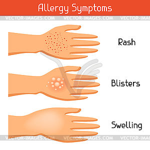 Allergy symptoms. for medical websites advertising - vector image