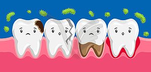 Sick teeth in oral cavity - vector image