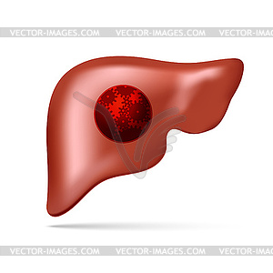 Human liver with gear and cogwheel - vector image