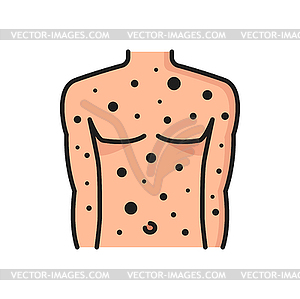 Allergy rash or acne symptom color line icon - vector clip art