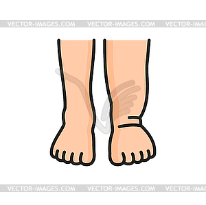 Lymphedema, swelling legs and edema color icon - vector EPS clipart