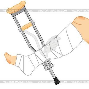 Gypsum on leg and crutches - vector clip art