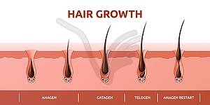 Hair growth cycle of follicles phase and hair root - vector EPS clipart