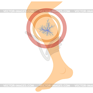 Spider Veins on Skin. Human Vessel, Health Arteries - vector image