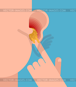 Finger in ear. Pick earwax with your finger - vector clipart