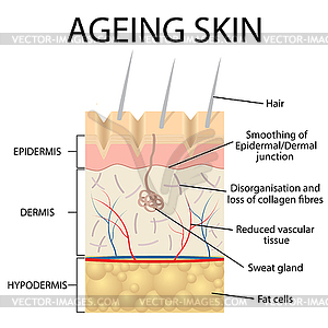 Old skin anatomy - vector image