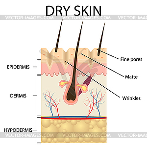 Layers of dry skin - vector clip art