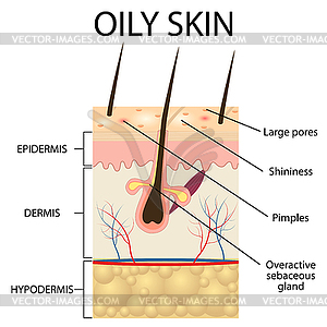 Layers of oily skin - vector clipart