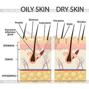 Human Skin types and conditions - vector clip art