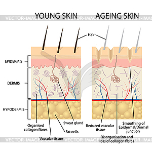 Young and older skin - vector clipart