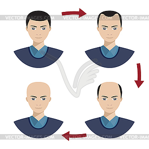 Four stages of hair loss for men - vector clipart