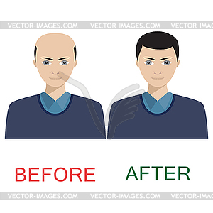 Man before and after hair treatment - vector image