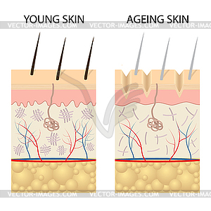 Young healthy skin and older skin comparison - vector image