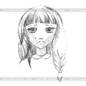 Acne vulgari - vector clipart