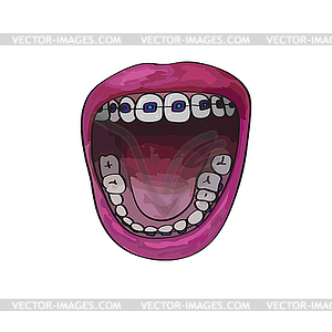 cartoon teeth with braces