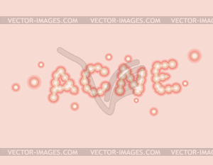 Acne lettering. Pimple lettersTypography. whelk - vector image