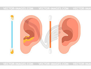 Human ear and ear stick. Ear cleaning stick - vector clip art